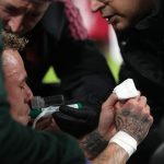 El jugador que casi pierde un dedo en la Champions, habló por primera vez de la escalofriante lesión: “No recuerdo qué pasó”